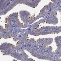 Anti-C5ORF49 antibody produced in rabbit 