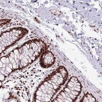 Anti-C6orf226 antibody produced in rabbit