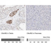 Anti-C6orf62 antibody produced in rabbit HPA030564-100UL