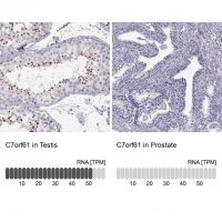 Anti-C7orf61 antibody produced in rabbit 