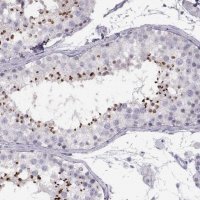Anti-C7orf61 antibody produced in rabbit 