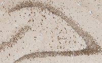 Anti-C9ORF72 (long form) Antibody, clone 1I9 ZooMAb� Rabbit Monoclonal 