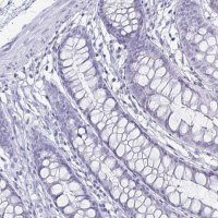Anti-CA9 antibody produced in rabbit 