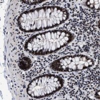 Anti-CAAP1 antibody produced in rabbit 