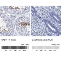 Anti-CABYR antibody produced in rabbit 