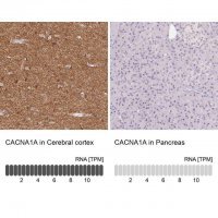 Anti-CACNA1A antibody produced in rabbit 