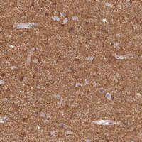 Anti-CACNA1A antibody produced in rabbit 