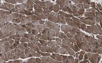 Anti-CACNA1C Antibody, clone 1F20 ZooMAb� Rabbit Monoclonal 