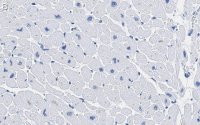 Anti-CACNA1C Antibody, clone 1F20 ZooMAb� Rabbit Monoclonal 
