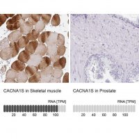 Anti-CACNA1S antibody produced in rabbit 