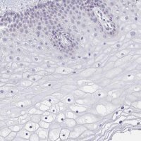 Anti-CACNA1S antibody produced in rabbit