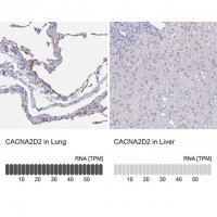 Anti-CACNA2D2 antibody produced in rabbit 