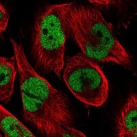 Anti-CAD antibody produced in rabbit 