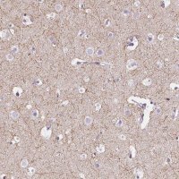 Anti-CADM4 antibody produced in rabbit 