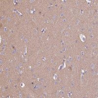 Anti-CADPS antibody produced in rabbit 