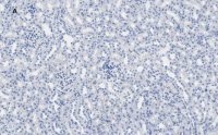 Anti-Calbindin D-28K clone 1A11 Antibody, ZooMAb� Rabbit Monoclonal 