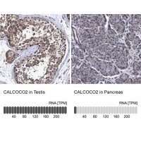 Anti-CALCOCO2 antibody produced in rabbit 