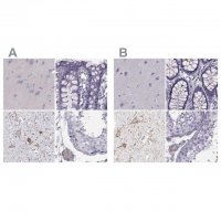 Anti-CALCR antibody produced in rabbit 