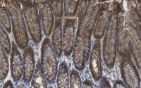 Anti-Calpain-9 Antibody, clone 1J22 ZooMAb� Rabbit Monoclonal 