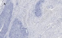 Anti-Calponin 1 Antibody, clone 9D14, ZooMAb� Rabbit Monoclonal 