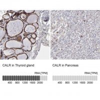 Anti-CALR antibody produced in rabbit HPA002242-100UL