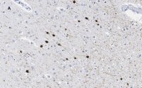 Anti-Calretinin Antibody, clone 3K22, ZooMAb� Rabbit Monoclonal 