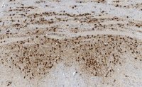 Anti-Calretinin Antibody, clone 6B8.2 ZooMAb� Mouse Monoclonal 