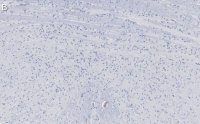 Anti-Calretinin Antibody, clone 6B8.2 ZooMAb® Mouse Monoclonal