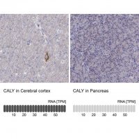 Anti-CALY antibody produced in rabbit