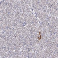 Anti-CALY antibody produced in rabbit