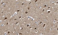Anti-CaM Kinase II Antibody, clone 1C20 ZooMAb� Rabbit Monoclonal 