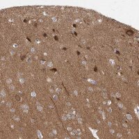 Anti-CAMK2B antibody produced in rabbit 