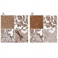 Anti-CAMSAP2 antibody produced in rabbit 