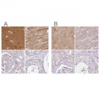 Anti-CAP2 antibody produced in rabbit 
