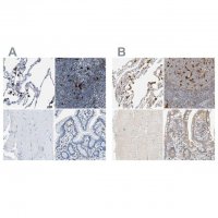 Anti-CAPG antibody produced in rabbit 