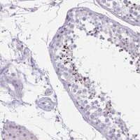Anti-CARD9 antibody produced in rabbit 