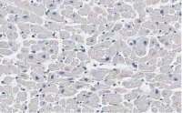 Anti-Cardiac Troponin I Antibody, clone 1F23, ZooMAb� Rabbit Monoclonal 