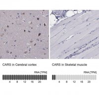 Anti-CARS antibody produced in rabbit 
