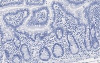 Anti-Caspase-1 (p20) Antibody, clone 2G4 , ZooMAb� Rabbit Monoclonal 