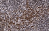Anti-Caspase-1 p10 Antibody, clone 9H11 ZooMAb� Rabbit Monoclonal 