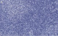 Anti-Caspase-1 p10 Antibody, clone 9H11 ZooMAb� Rabbit Monoclonal 