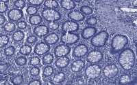 Anti-Caspase-8 Antibody, clone 1L15 ZooMAb� Rabbit Monoclonal 
