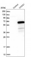 Anti-CASQ1 antibody produced in rabbit 