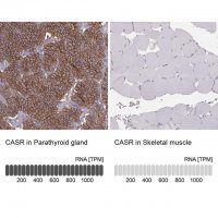 Anti-CASR antibody produced in rabbit 