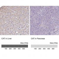 Anti-CAT antibody produced in rabbit