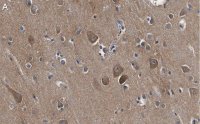 Anti-Catenin- 2 Antibody, clone 3F7 ZooMAb� Rabbit Monoclonal 