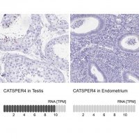 Anti-CATSPER4 antibody produced in rabbit 