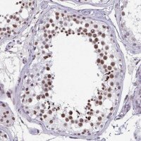 Anti-CBFA2T2 antibody produced in rabbit HPA060523-100UL