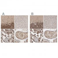 Anti-CBLL1 antibody produced in rabbit 