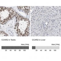 Anti-CCAR2 antibody produced in rabbit 